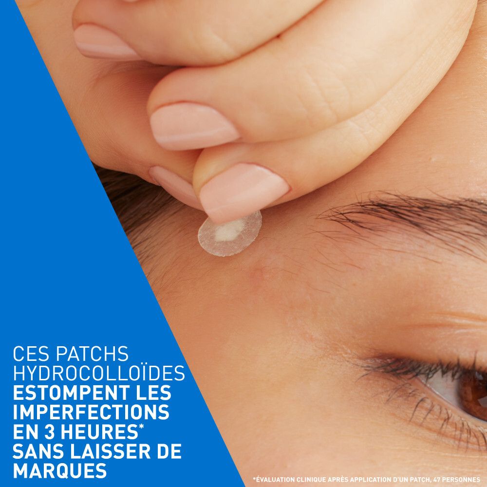 Main appliquant un patch sur la peau. Le patch est transparent et rond.