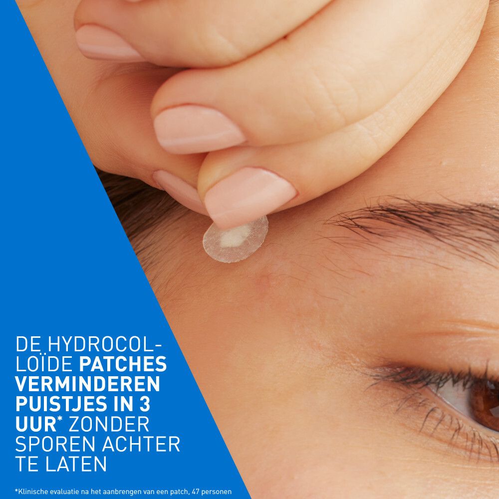 CeraVe Anti-Onzuiverheden Patches. Verpakking met 22 patches. Blauw-witte verpakking met productinformatie.