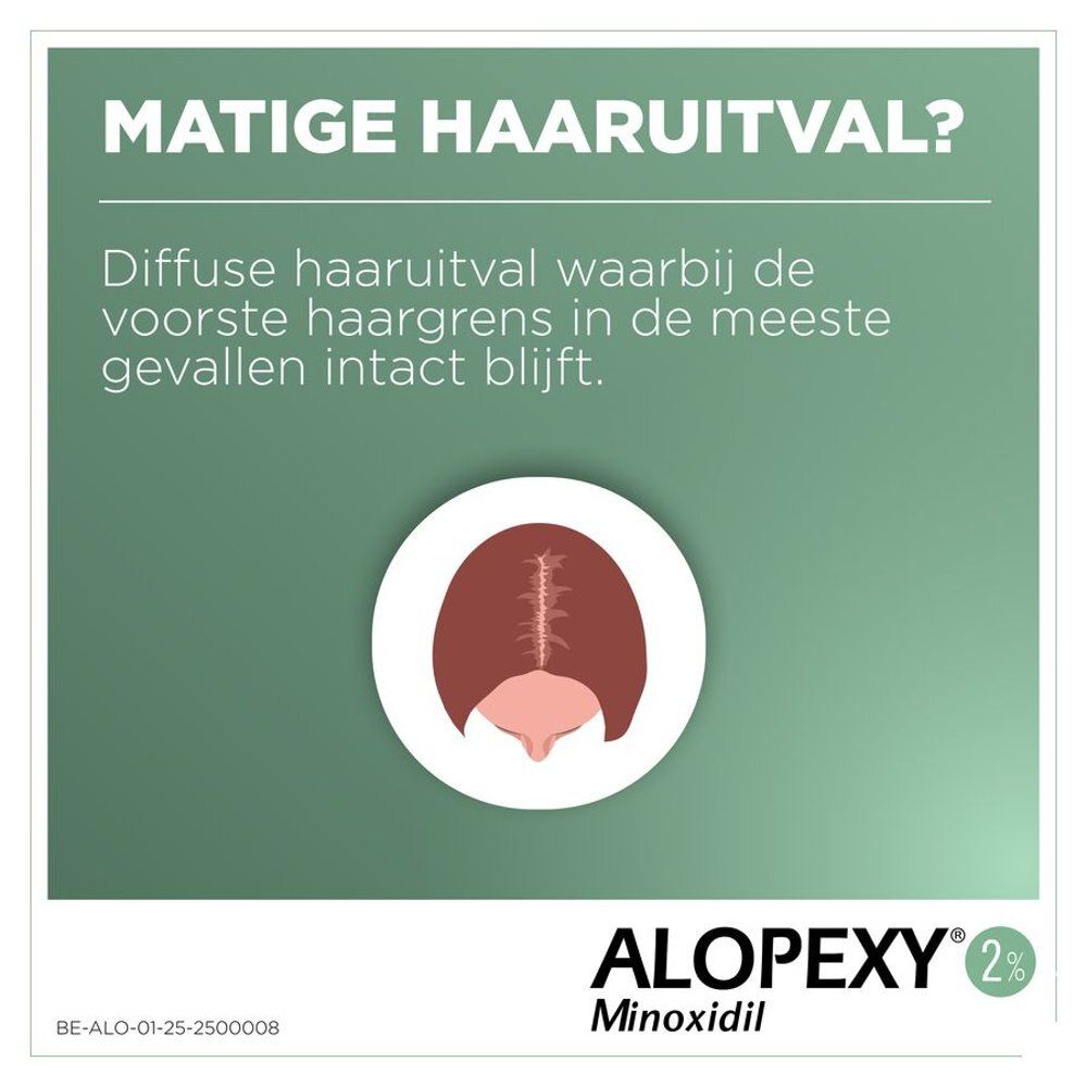 Grafiek met haaruitval. Alopexy 2 % en Minoxidil. Weergave van haaruitval.
