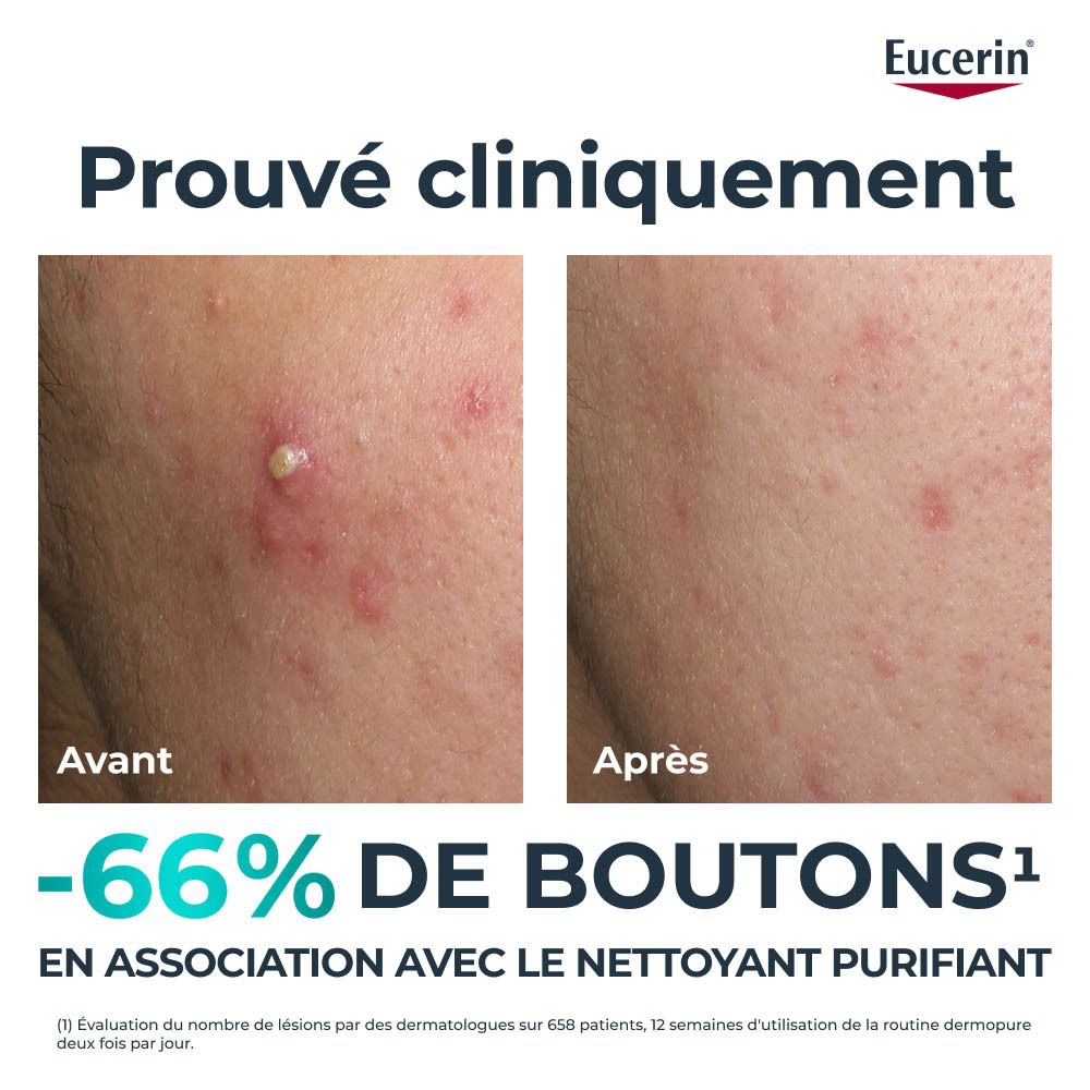 Eucerin DERMOPURE CLINICAL. Produit et emballage. Texte: Triple Action, 2% Acide salicylique.