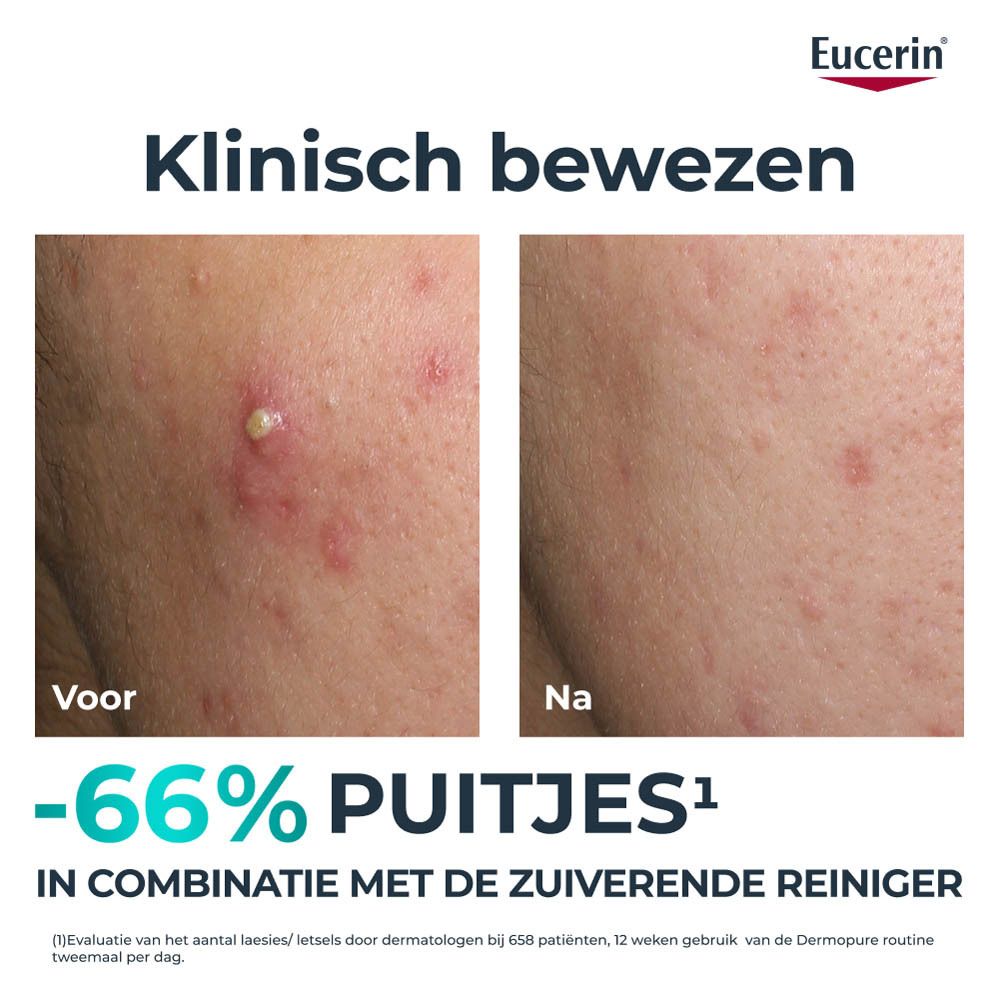 Eucerin DERMOPURE CLINICAL. Product en verpakking. Tekst: Triple Action, 2% Salicylzuur.
