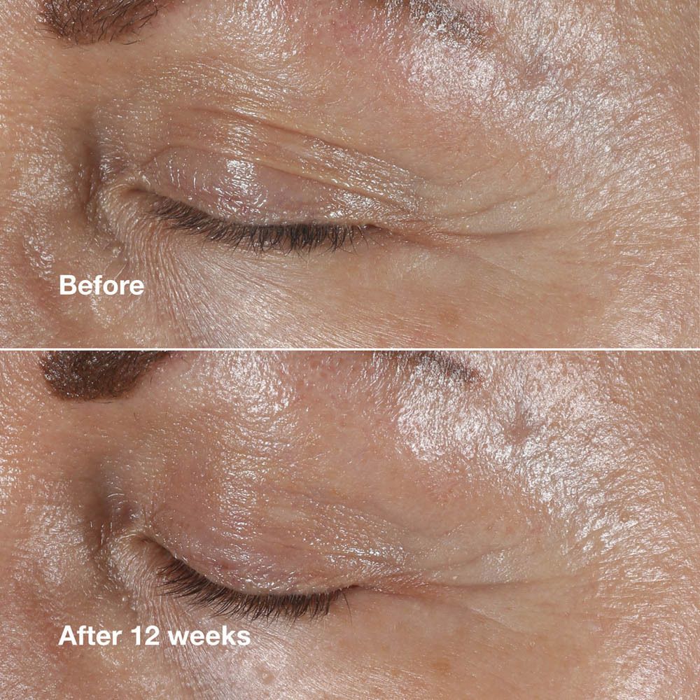 Clinique Smart Clinical Repair Wrinkle Eye Cream