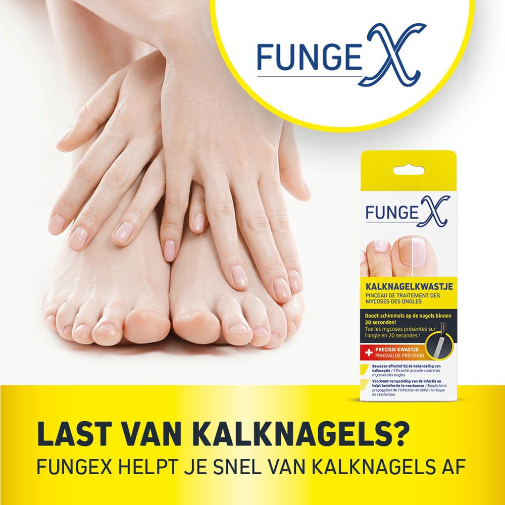 Voeten en FungeX-verpakking. Tekst: 'LAST VAN KALKNAGELS?' FungeX-verpakking op de achtergrond.