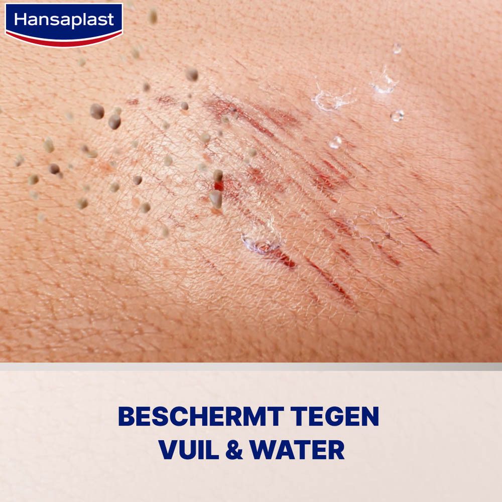 Wond op huid. Hansaplast Vloeibare Pleister Concentraat. Beschermt tegen vuil en water.