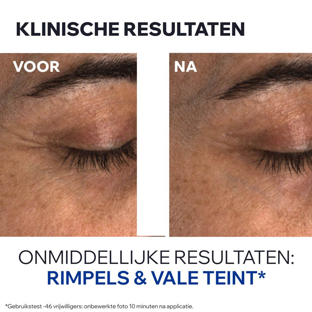 Voor-en-na vergelijking van ogen. Tekst: Onmiddellijke resultaten: rimpels & vale teint.