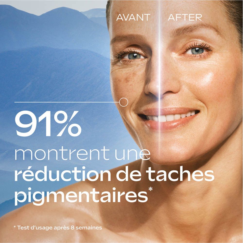 Visage d'une femme. Comparaison avant-après. Texte : 91% montrent une réduction des taches pigmentaires.