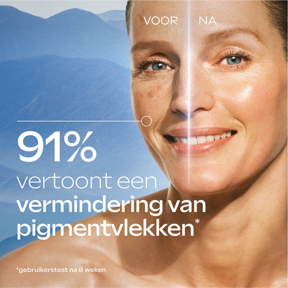 Gezicht van een vrouw. Voor-na vergelijking. Tekst: 91% vertoont een vermindering van pigmentvlekken.