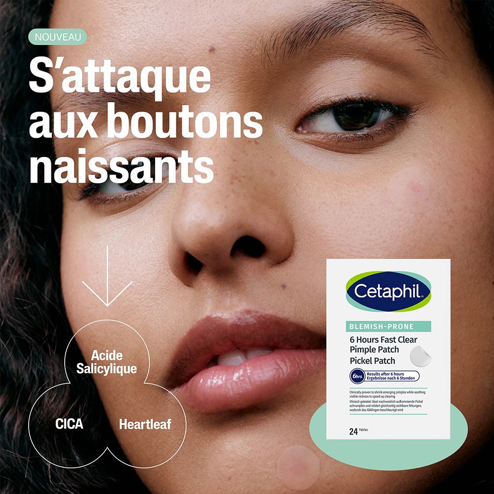 Gros plan d'un visage. Emballage Cetaphil Pimple Patch. Texte: S'attaque aux boutons naissants.