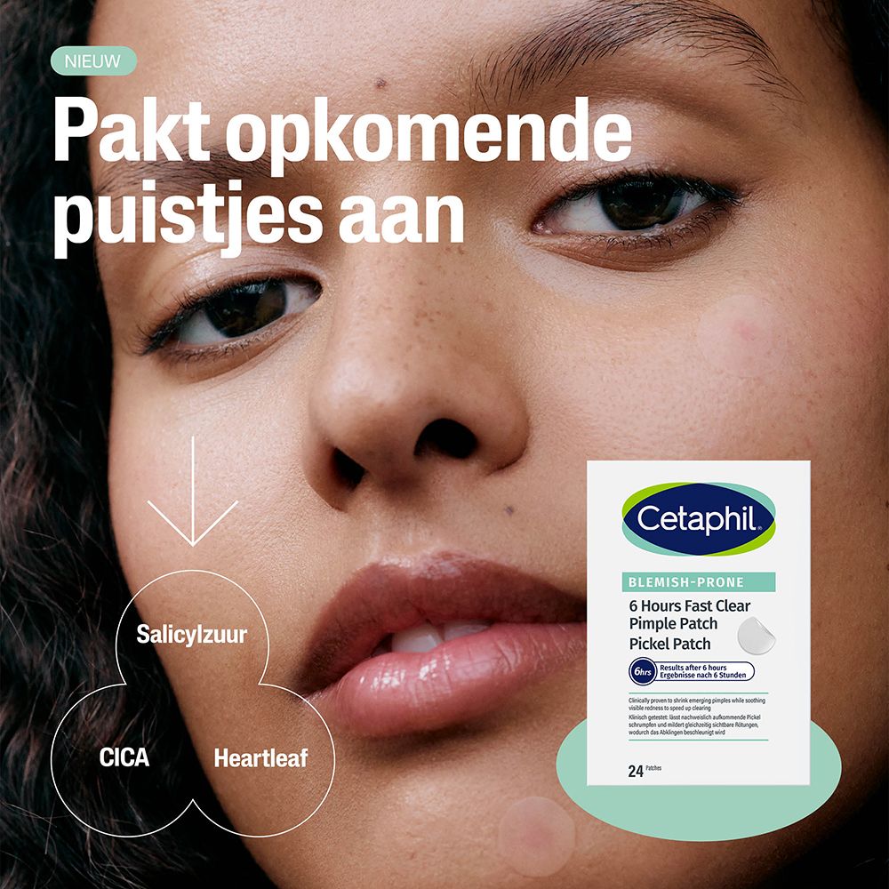 Close-up van een gezicht. Cetaphil Pimple Patch verpakking. Tekst: Pakt opkomende puistjes aan.