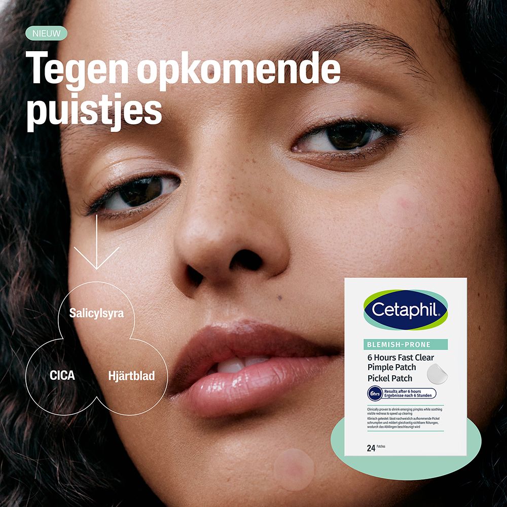 Close-up van een gezicht. Cetaphil Pimple Patch verpakking. Tekst: Tegen opkomende puistjes.