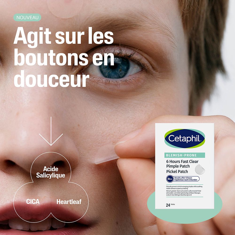 Gros plan d'un visage. Emballage Cetaphil Pimple Patch. Texte: Agit sur les boutons en douceur.