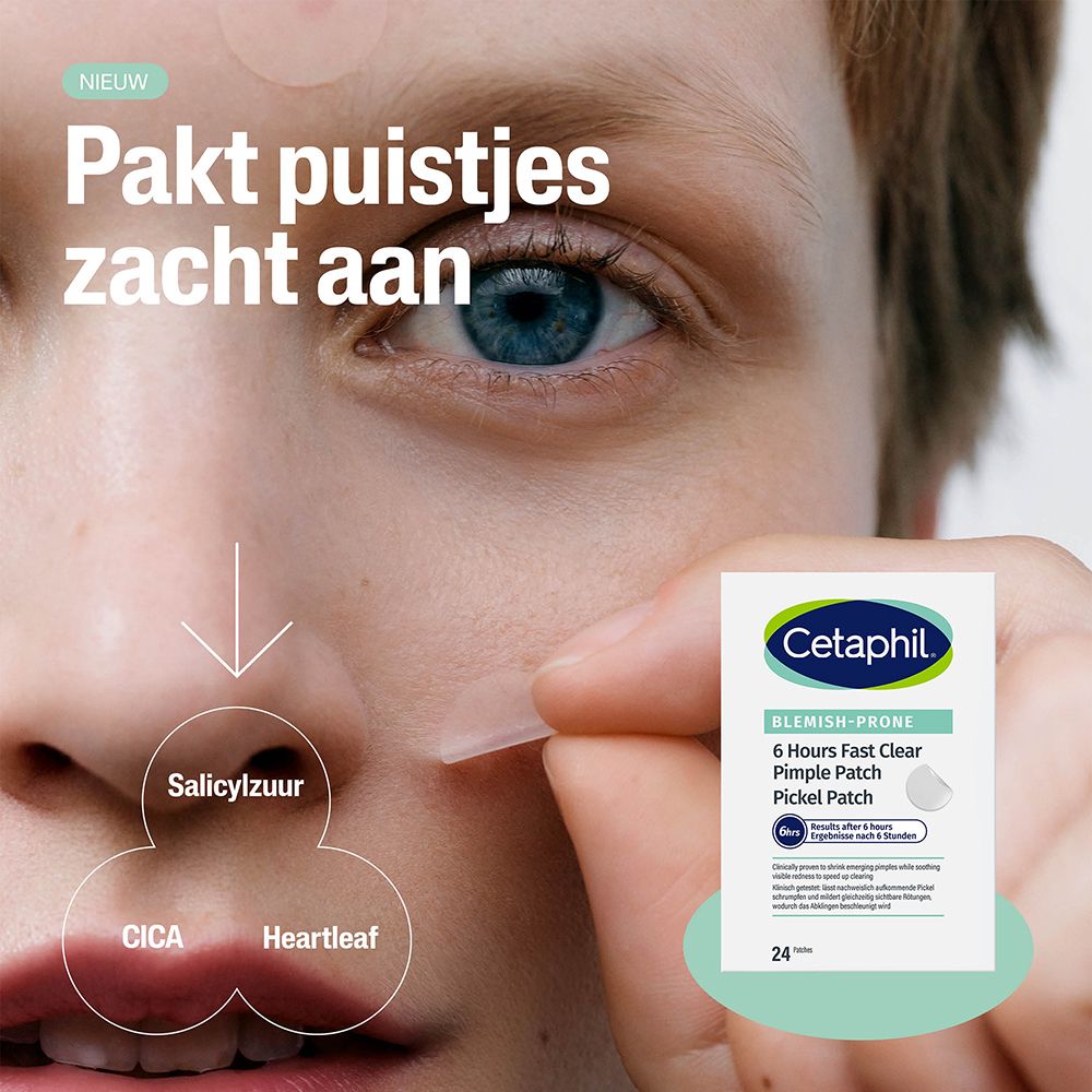 Close-up van een gezicht. Cetaphil Pimple Patch verpakking. Tekst: Snel werkende pimple patch.