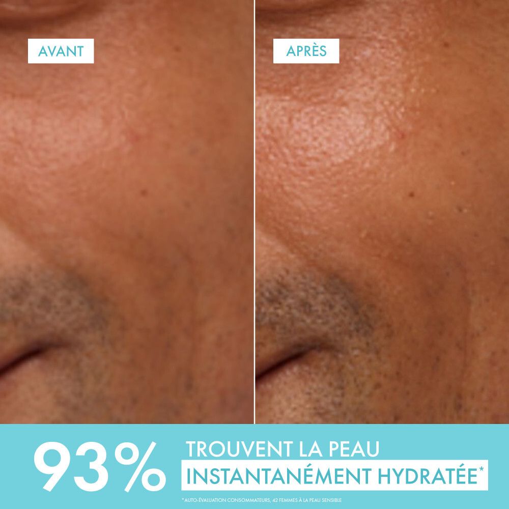 Peau du visage avant et après. Texte : 93% hydratation instantanée.