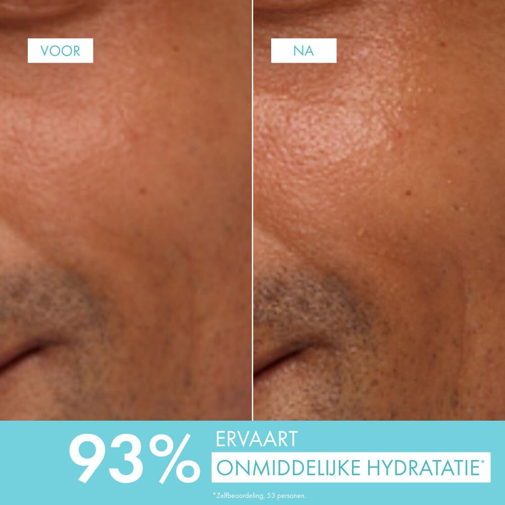 Gezichtshuid voor en na. Tekst: 93% onmiddellijke hydratatie.