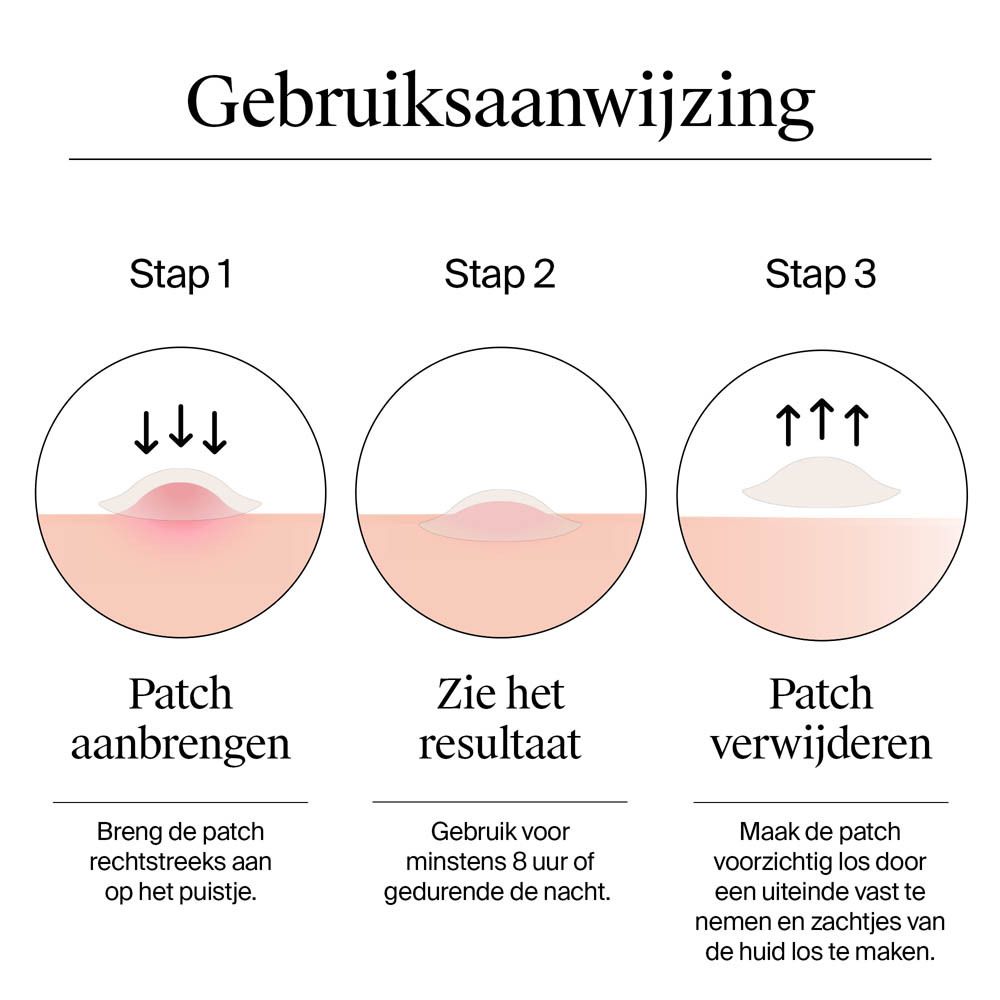 Toepassing: 1. Patch aanbrengen. 2. Het resultaat zien. 3. Patch verwijderen. Illustraties.