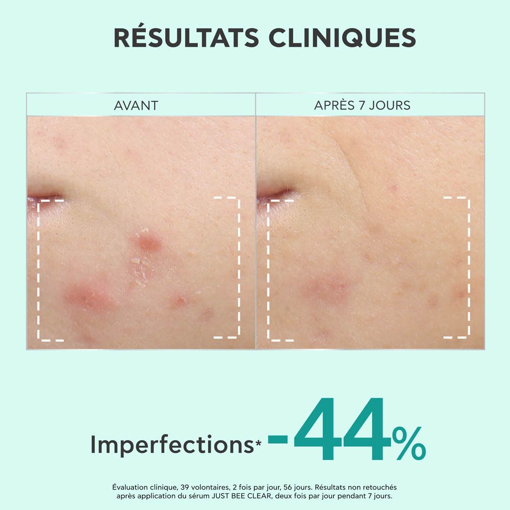 Diagramme. Texte : Propolis AmC inhibe la formation du biofilm de C. acnes.