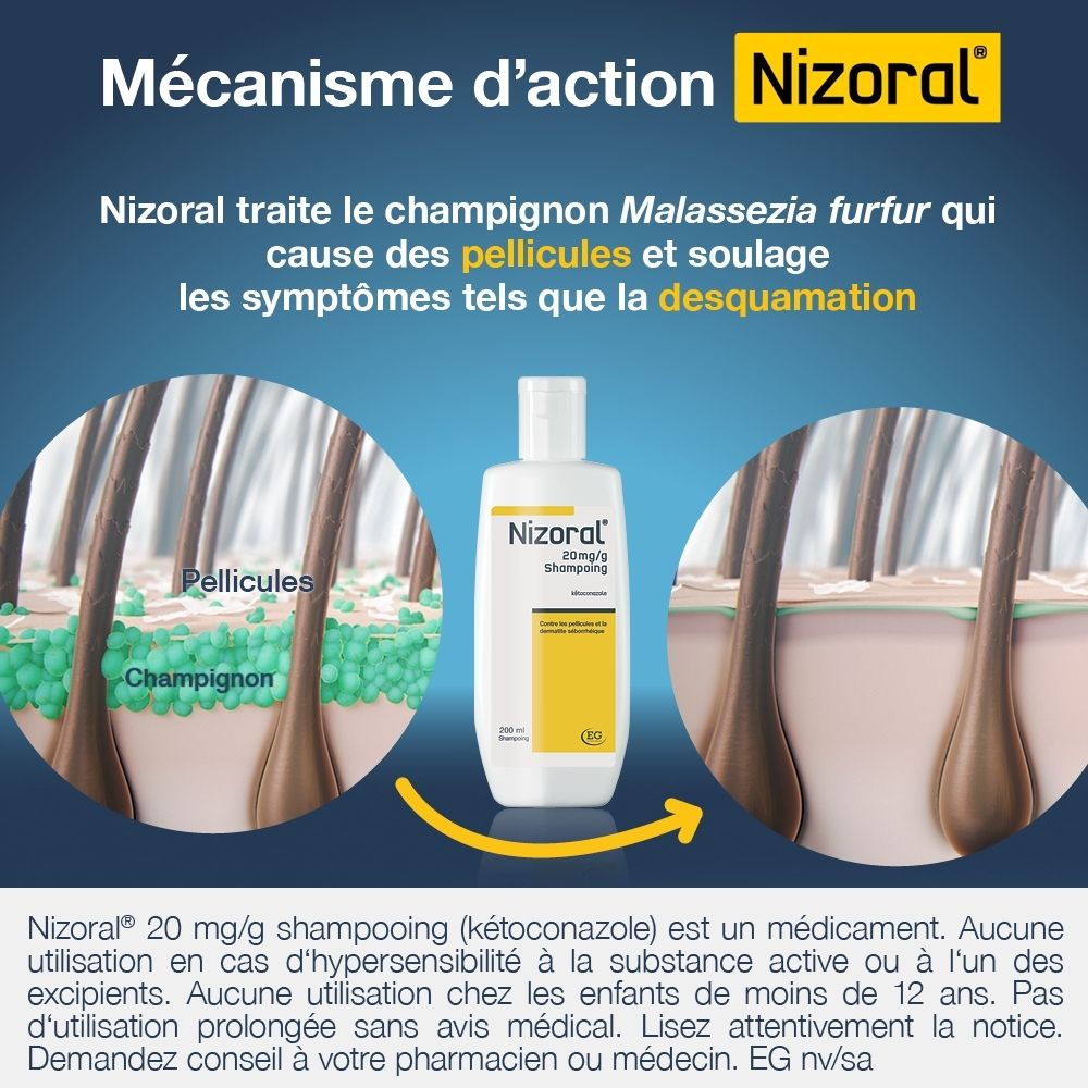 Nizoral Shampooing 20 mg/g, pourquoi Nizoral? Ne traite pas seulement les symptômes, mais cible la cause des pellicules.