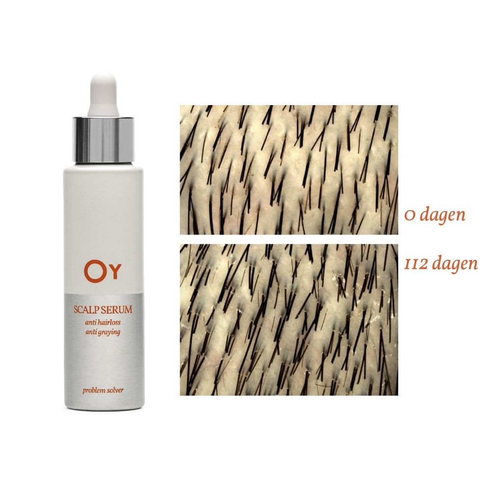 Achterkant van een Oy Scalp Serum fles met gebruiksinstructies en ingrediënten.