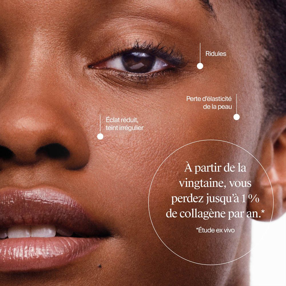 Gros plan du visage d'une femme montrant des signes de vieillissement cutané.