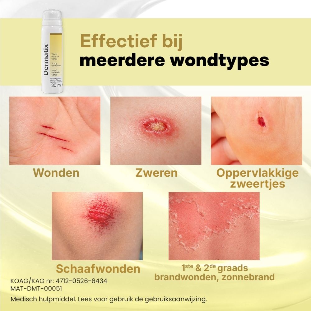 Dermatix Wond-helende Spray: Kind met knieblessure, toont 4x snellere wondgenezing.