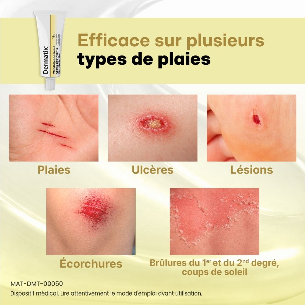 Dermatix Crème cicatrisante 32g. Tube avec crème appliquée.