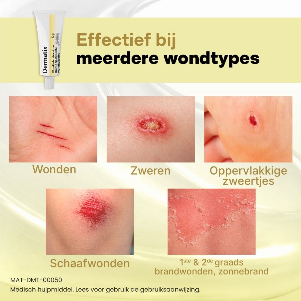 Dermatix Wondhelende Crème 32g. Tube met aangebrachte crème.