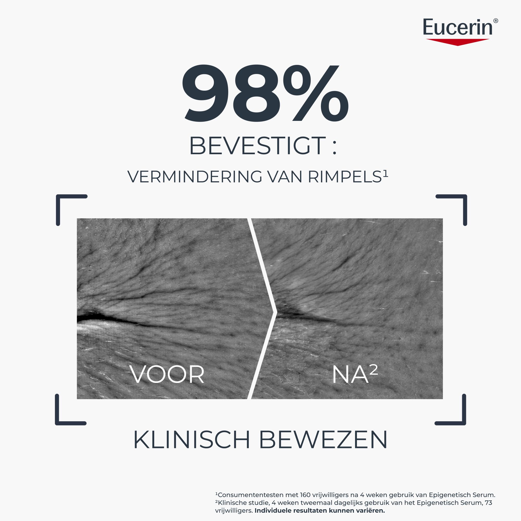 Vergelijking van huid voor en na gebruik Eucerin Hyaluron-Filler + Longevity Serum.