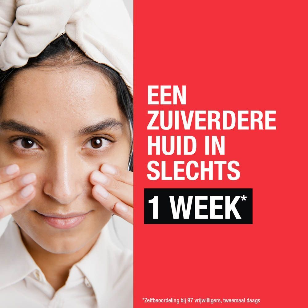 Vrouw met een handdoek op haar hoofd. Tekst: Een zuiverdere huid in slechts 1 week.