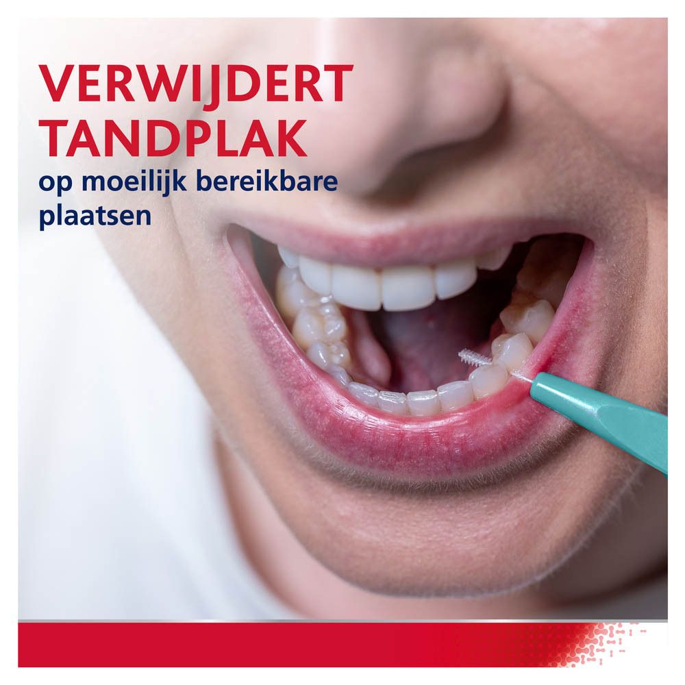 Mond met interdentale borstel. Verwijdert tandplak op moeilijk bereikbare plaatsen. Tekst: Verwijdert tandplak.