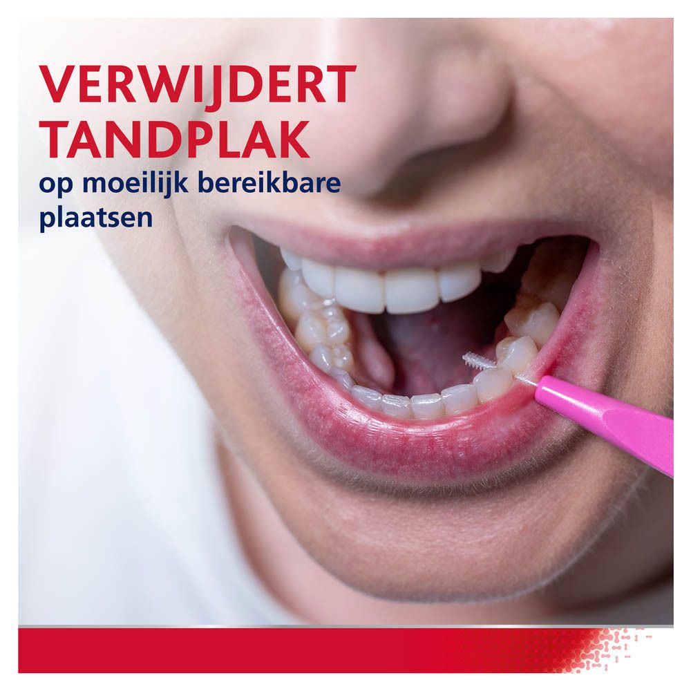 Interdentale borstel verwijdert tandplak op moeilijk bereikbare plaatsen.