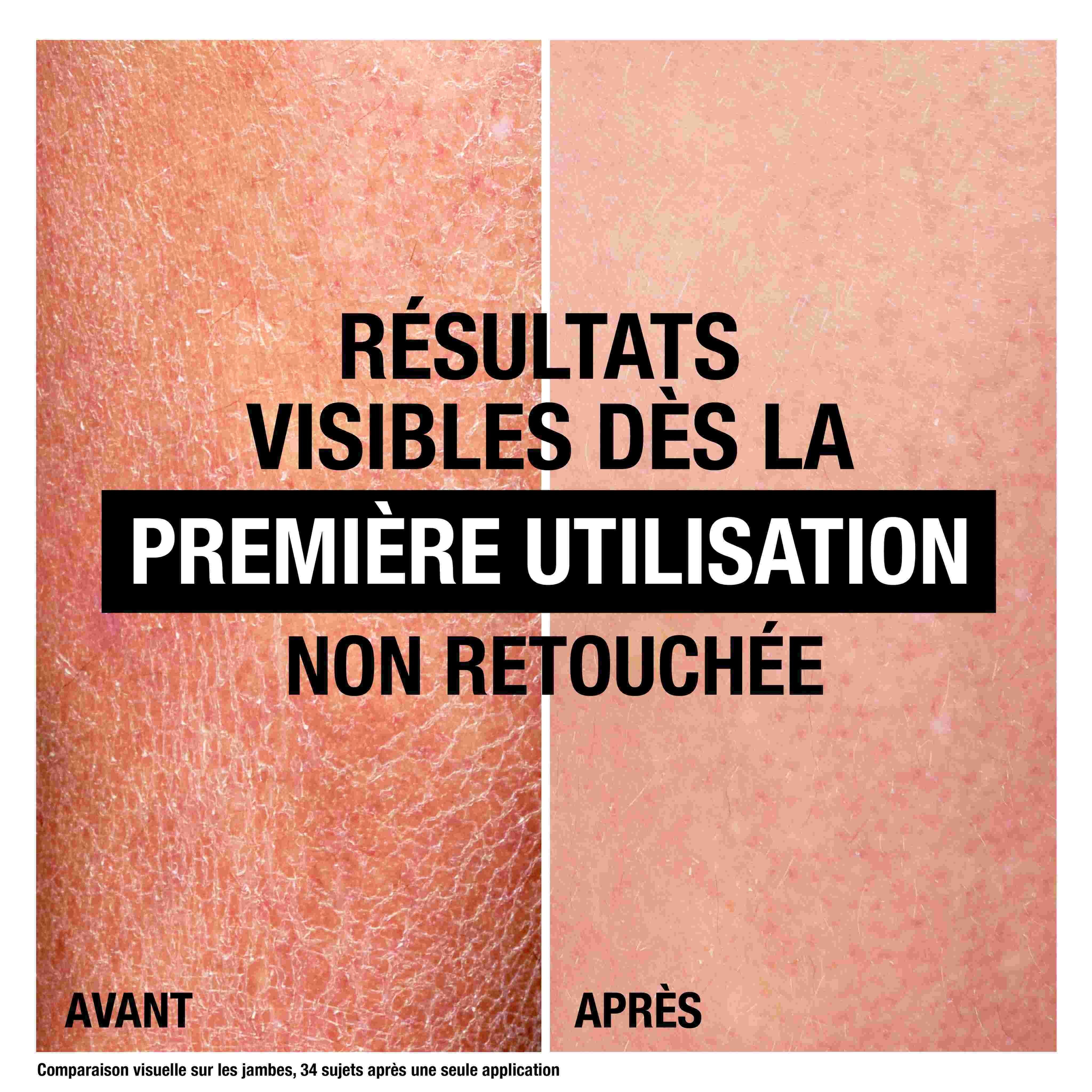 Comparaison de la peau avant et après. Texte: Résultats visibles dès la première utilisation.
