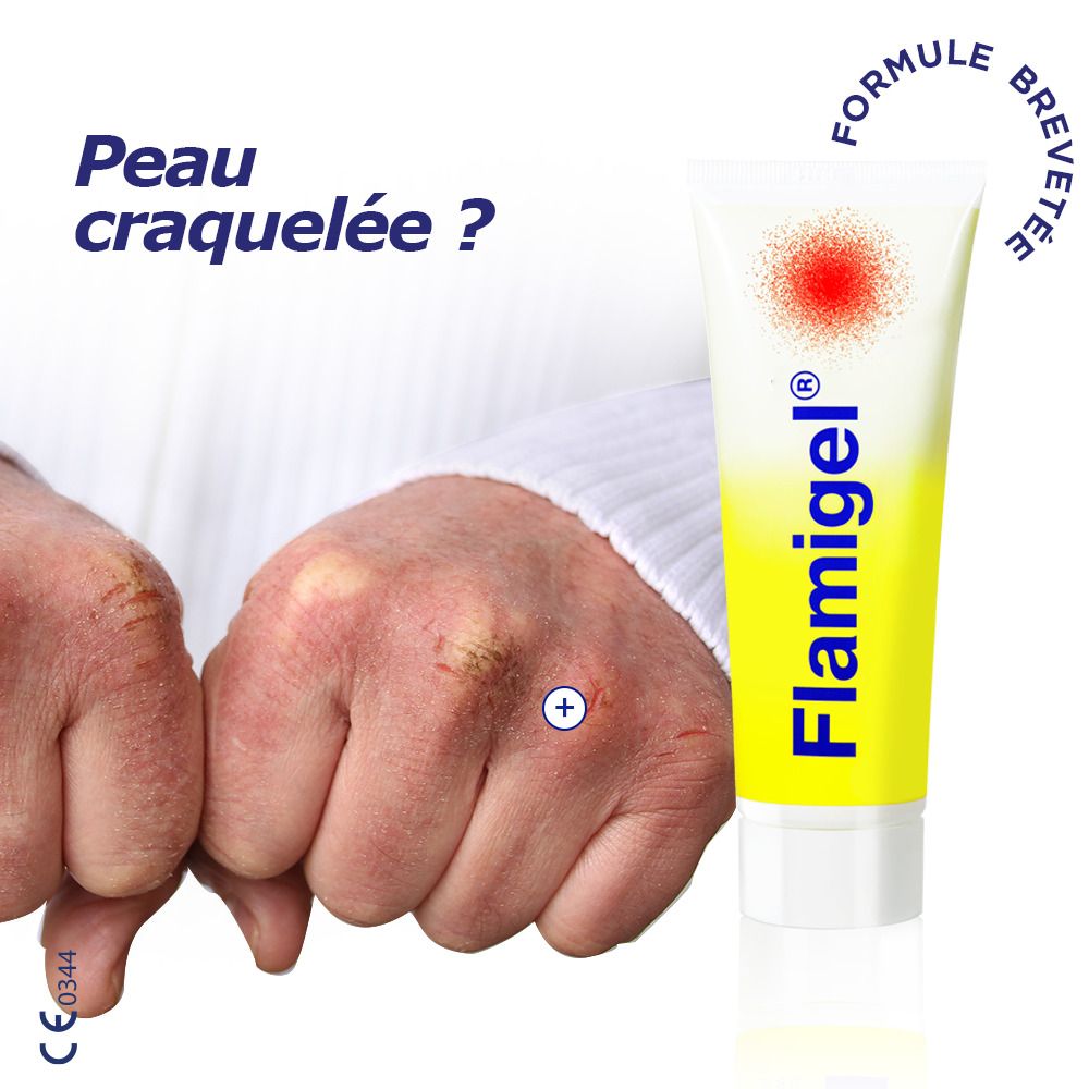 Tube de Flamigel. Jaune avec point rouge. Mains avec peau craquelée.