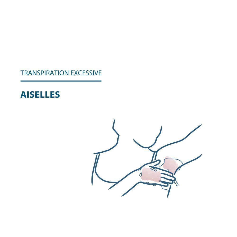 Illustration : transpiration excessive, aisselles. Une personne applique du liquide.