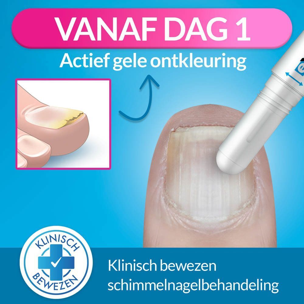 Nagel met schimmel. Witte applicator. Tekst: Klinisch bewezen. Behandeling van schimmelnagels.