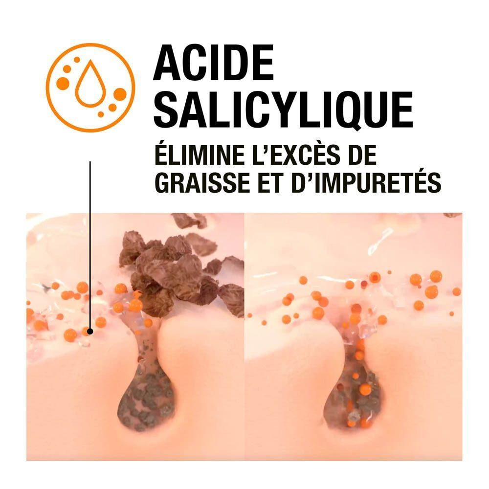 Illustration des pores avec acné avant et après l'utilisation de Neutrogena Clear & Defend Gel Nettoyant Quotidien.