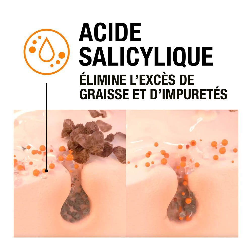 Illustration des pores de la peau avant et après le traitement à l'acide salicylique. Élimine l'excès de sébum et les impuretés.