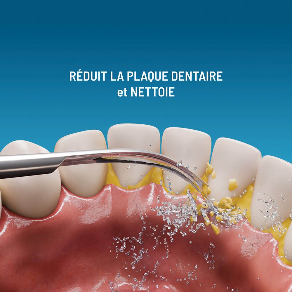 Nettoyage dentaire avec un embout. Réduit la plaque et nettoie les dents.