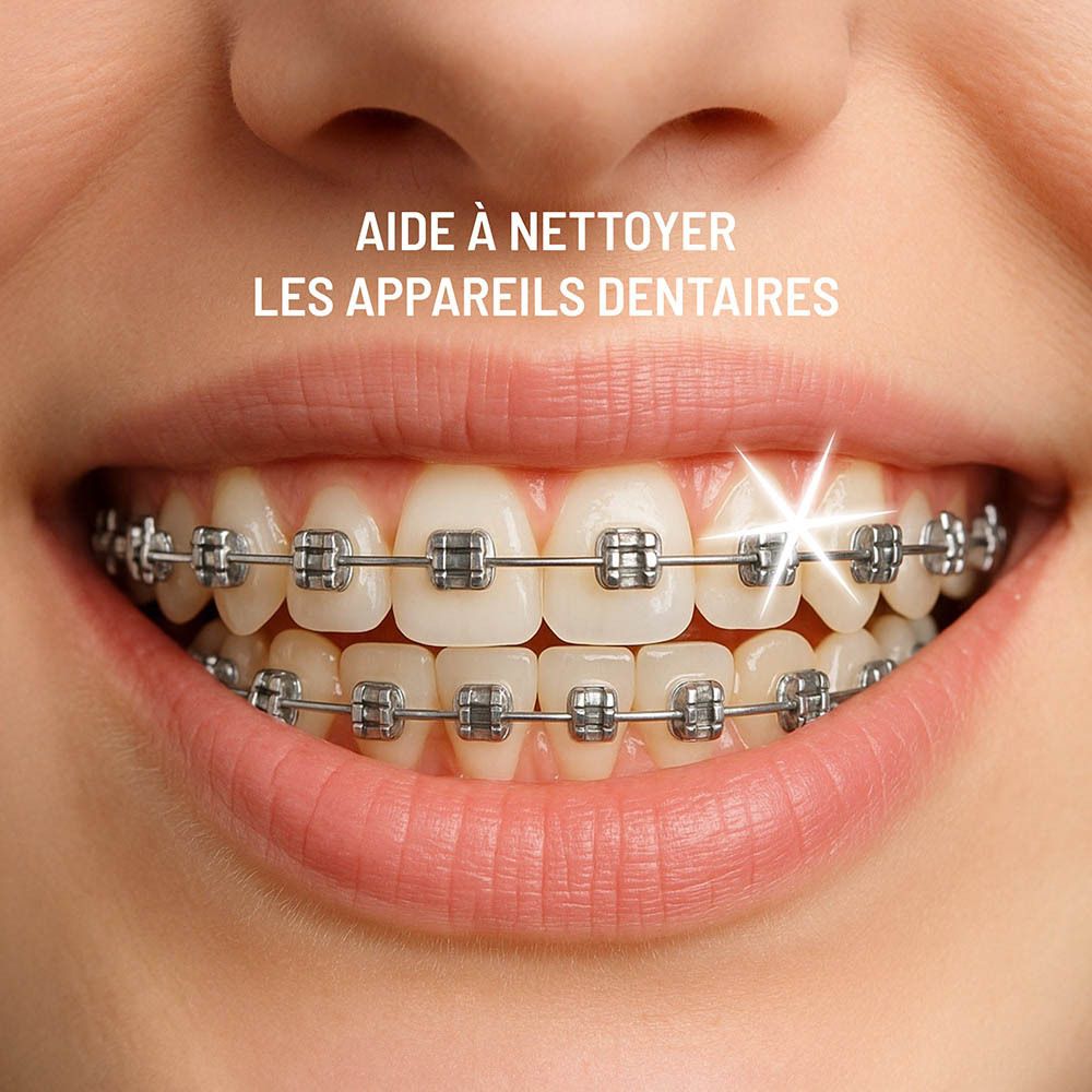 Brosse à dents nettoyant les appareils dentaires. Aide à nettoyer les appareils dentaires.
