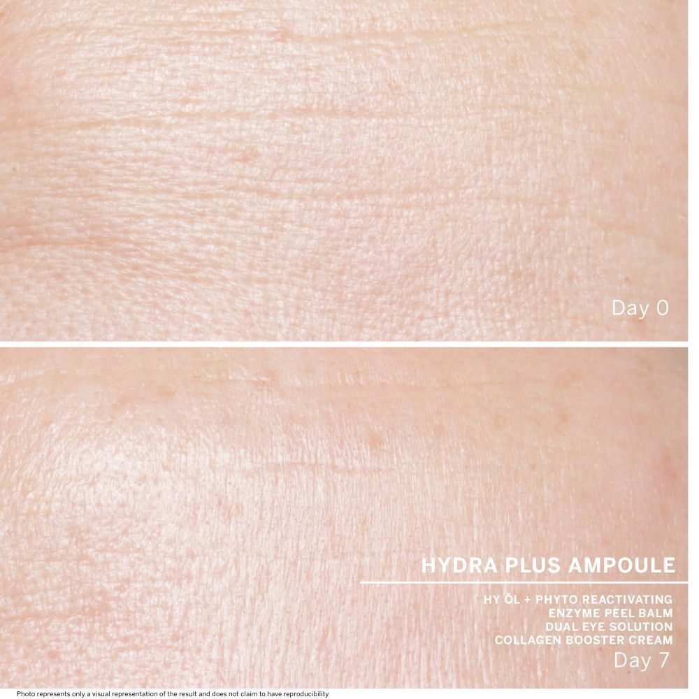 Twee huidbeelden, dag 0 en dag 7. Tekst: Hydra Plus Ampul, Hy Ol, Enzyme Peel Balm, Dual Eye Solution, Collagen Booster Cream.