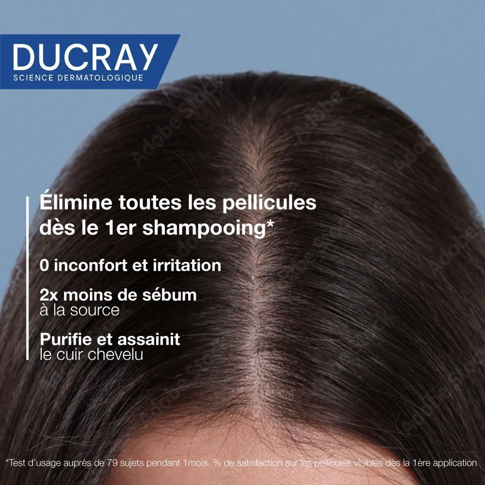 Gros plan d'une tête avec implantation des cheveux. Texte : Elimine toutes les pellicules dès le 1er shampooing.