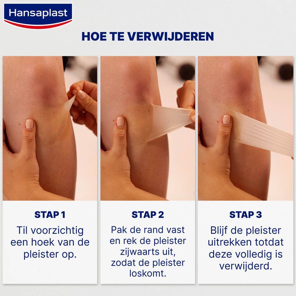 Pleister verwijderen in 3 stappen. Stap 1: Hoekje optillen. Stap 2: Pleister uitrekken. Stap 3: Verwijderen.