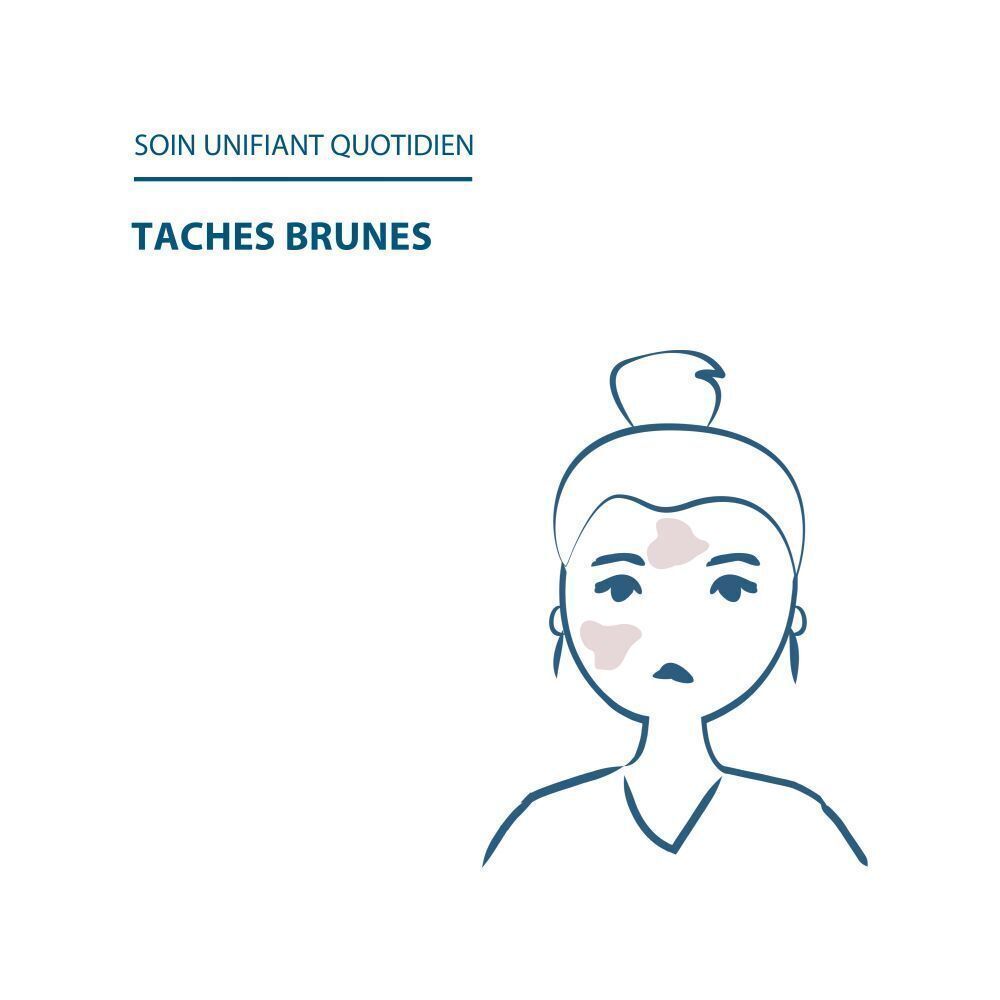 Visage de femme avec taches pigmentaires. Texte: Soin unifiant quotidien. Taches brunes.