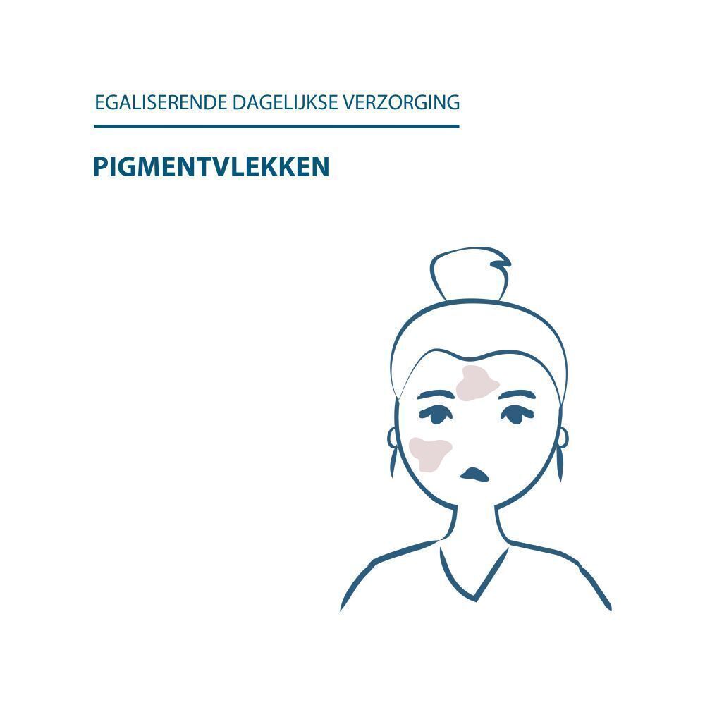 Vrouwengezicht met pigmentvlekken. Tekst: Egaliserende dagelijkse verzorging. Pigmentvlekken.