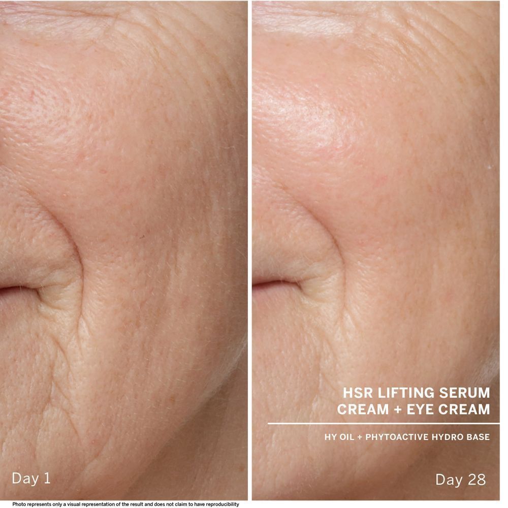 Voor-en-na vergelijking van de huid. Tekst: HSR Lifting Serum Cream + Eye Cream. Dag 1 en Dag 28.