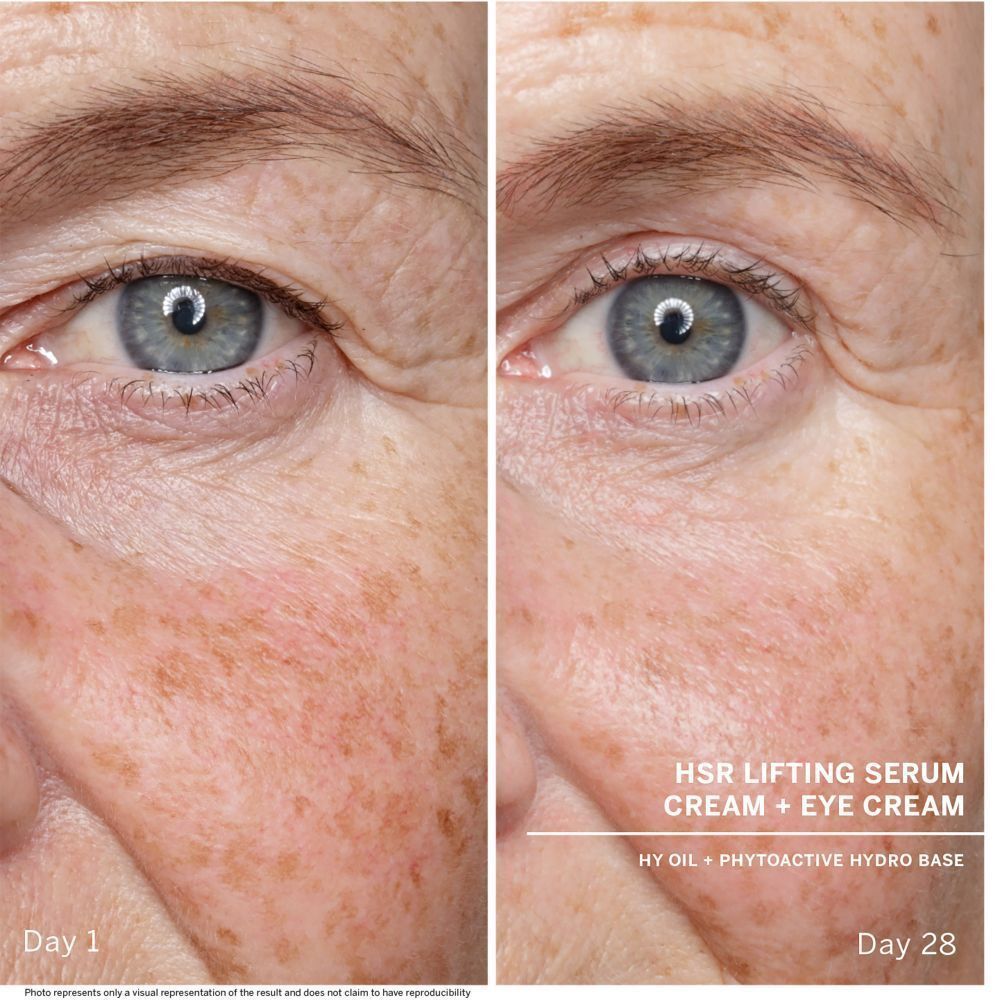 Voor-en-na vergelijking van de huid. Tekst: HSR Lifting Serum Cream + Eye Cream. Dag 1 en Dag 28.