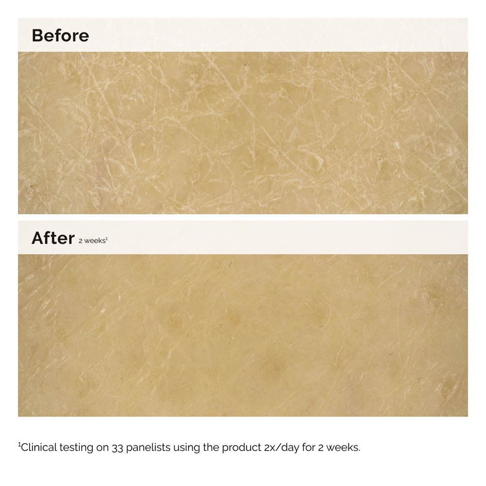 Comparaison avant-après. Peau avant et après 2 semaines d'utilisation. Texte : Clinical testing on 33 panelists using the product 2x/day for 2 weeks.