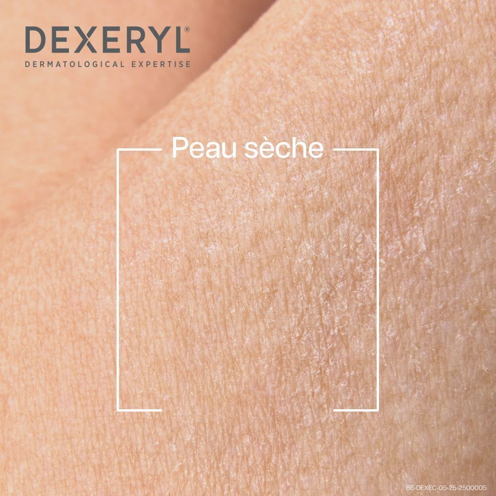 Gros plan sur peau sèche. Encadré blanc. Texte en français : Peau sèche.