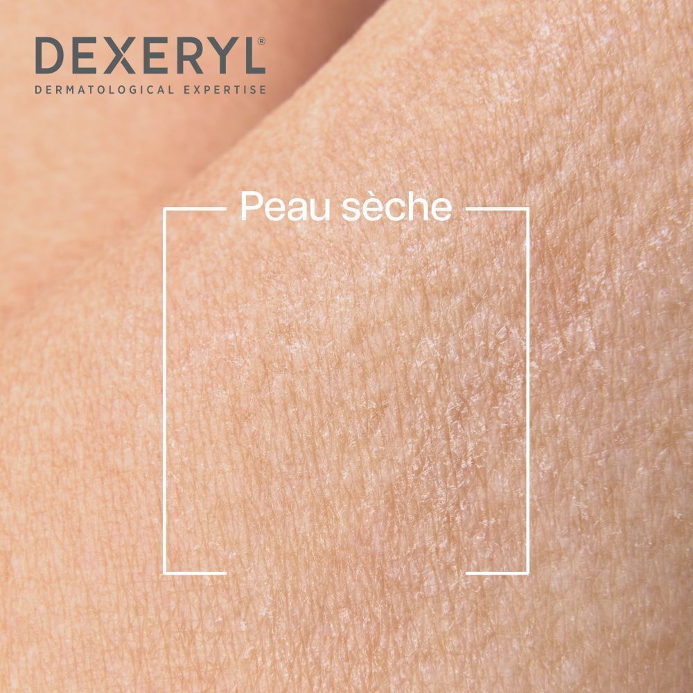 Gros plan sur peau sèche. Marquage carré. Texte: Peau sèche.