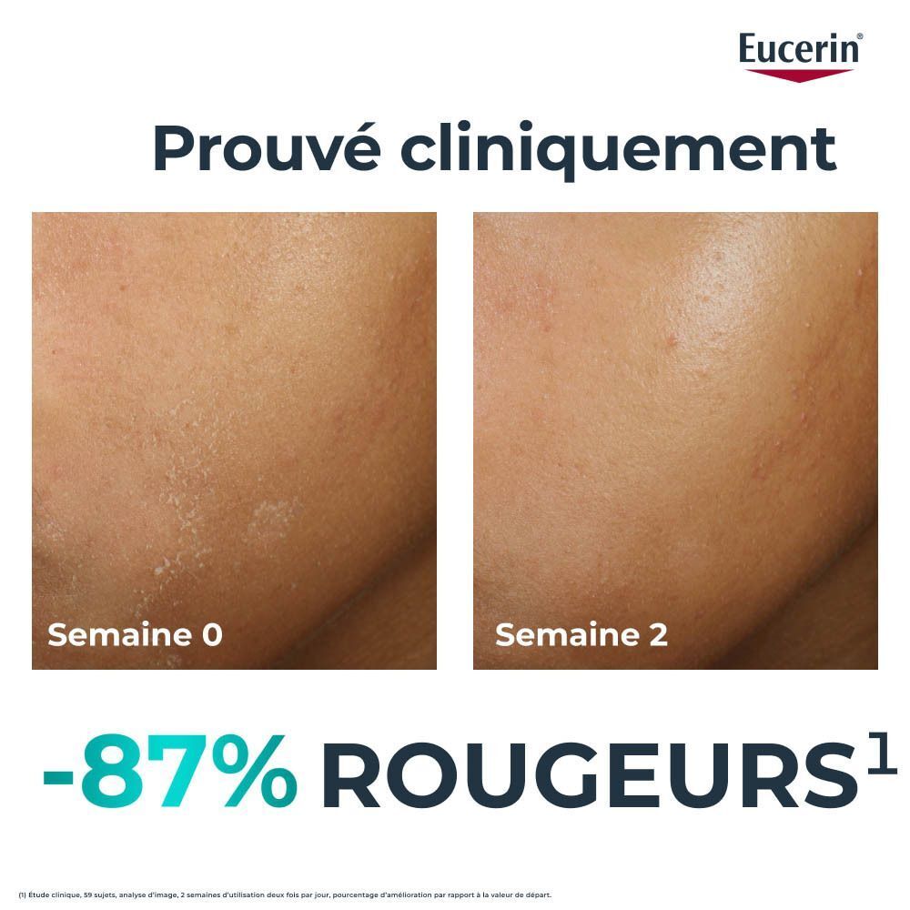 Peau du visage avant et après application. Texte : Prouvé cliniquement. -87% Rougeurs.
