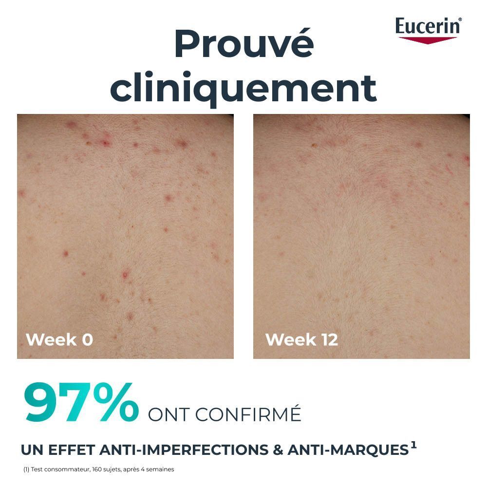 Peau avant et après. Texte : 97% confirment un effet anti-imperfections et anti-marques.